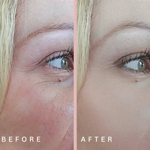 Redlight therapy results for wrinkles Derma Therapy Mask